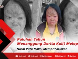 Puluhan Tahun Menanggung Derita Kulit Melepuh, Nasib Putu Malini Memprihatinkan